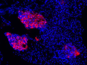 Vue de deux îlots de Langerhans d'un pancréas murin. En rouge, les cellules bêta sécrétrices d'insuline. ©IGBMC